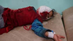 Ein Mädchen wurde durch einen saudischen Raketenangriff auf Saada verletzt
