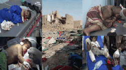 Spokesman Rescue gov. condemns al-Jawf massacre as war crime