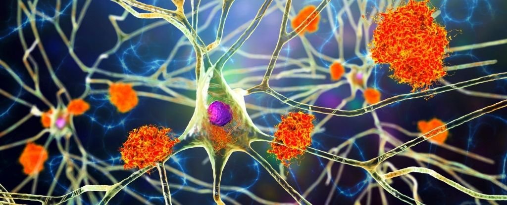 دراسة 500000 من السجلات الطبية تربط الفيروسات بمرض ألزهايمر مرارًا وتكرارًا دراسة 500000 من السجلات الطبية تربط الفيروسات بمرض ألزهايمر مرارًا وتكرارًا