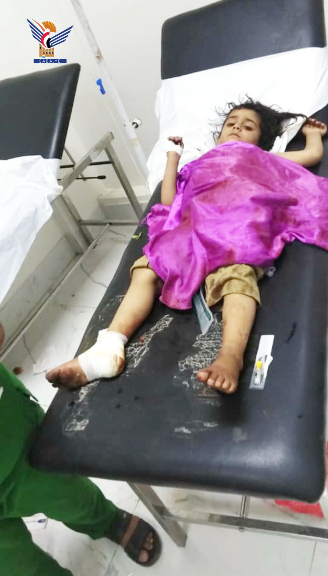 21 civiles murieron y resultaron heridos como consecuencia de la explosión de bombas de racimo y restos de guerra el pasado mes de noviembre