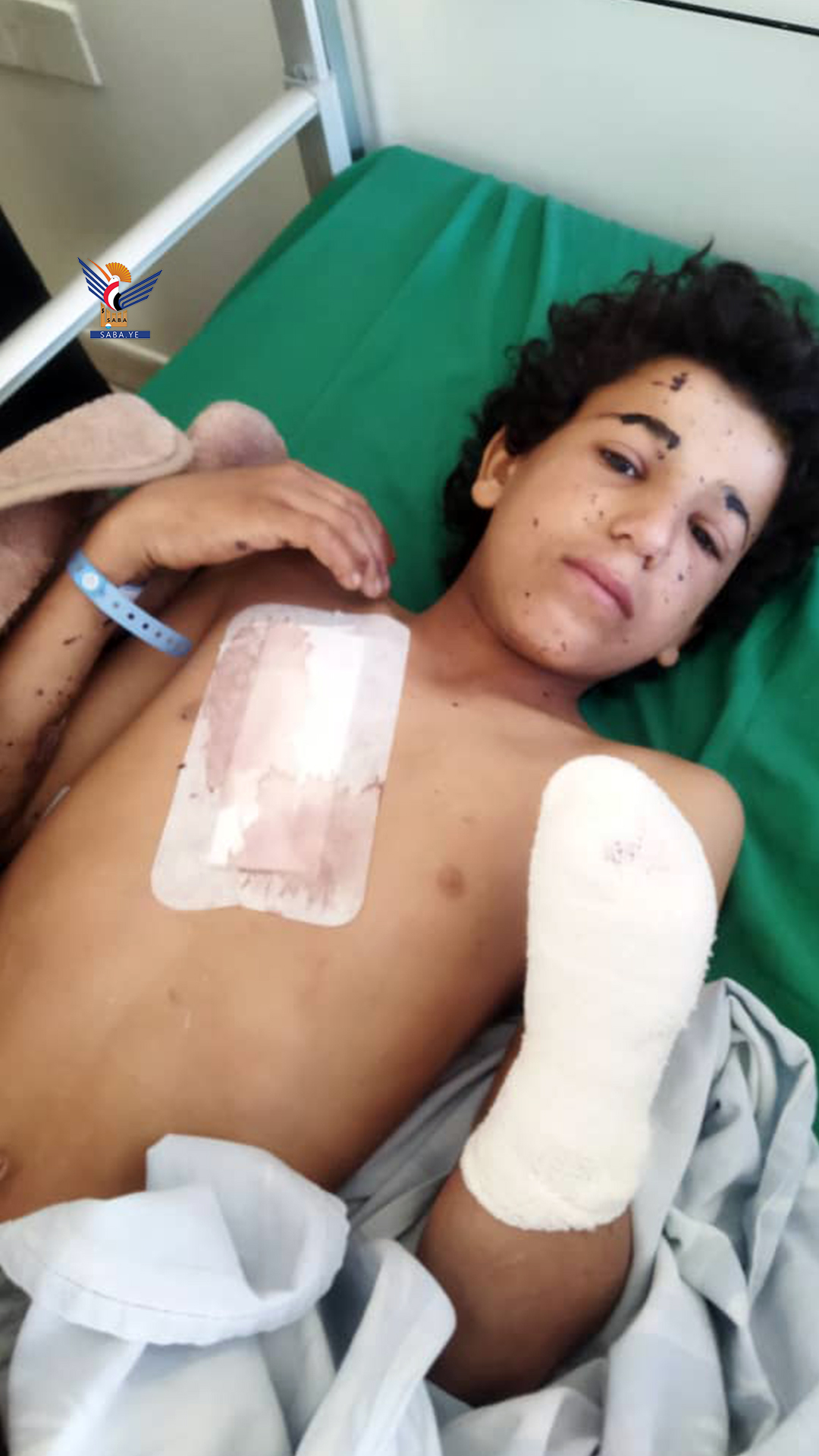 A child was injured by an aggression explosion remnant in Marib