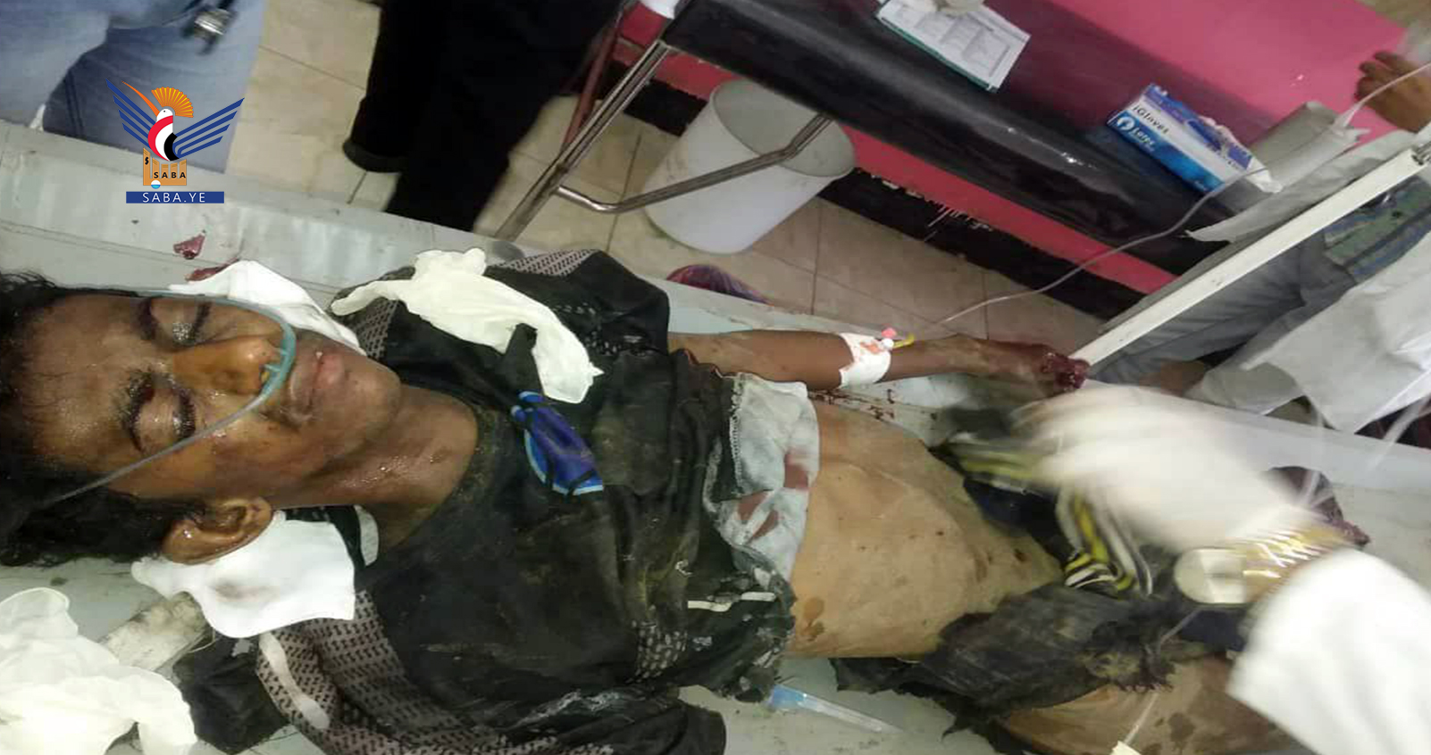 Verletzung eines Zivilstes durch Minenexplosion der Überreste der Aggression in Al-Hawk, Hodeidah