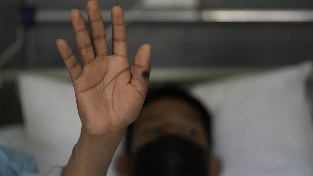 Financial Times: 12 African countries struggle to contain monkeypox outbreak Financial Times: 12 African countries struggle to contain monkeypox outbreak
