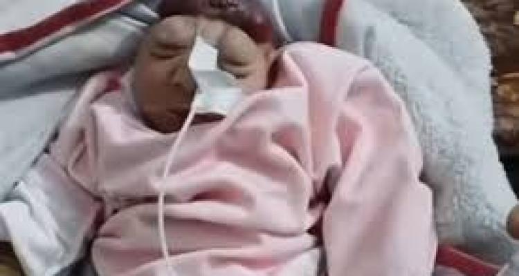 UNRWA Warns: Newborns in Gaza showing unprecedented genetic changes UNRWA Warns: Newborns in Gaza showing unprecedented genetic changes