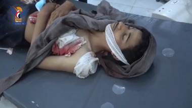 Un garçon tué par les balles des mercenaires de l'agression à Sabir Al Mawadim, gouvernorat de Taiz