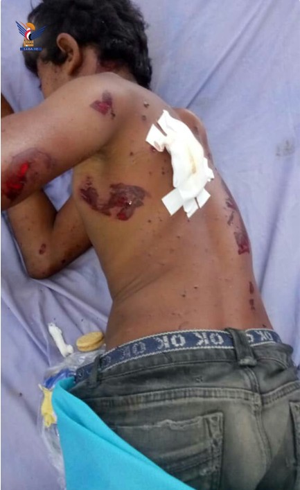 دو کودک در انفجار یک ماده‌ی بقایای تجاوزات دشمن در ولسوالی الحالی در الحدیدة زخمی شدند
