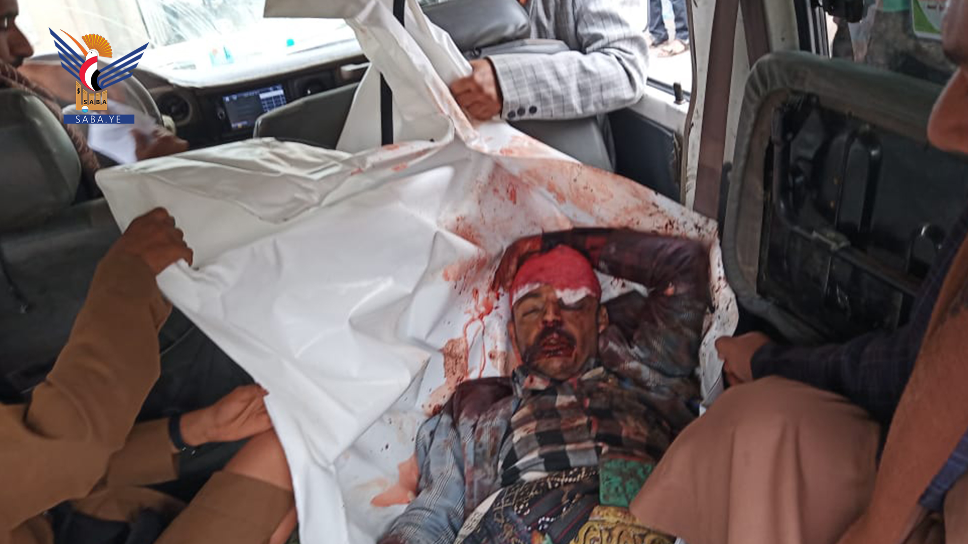 Citizen injured by mercenary's snipers in Taiz