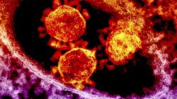 الولايات المتحدة تصبح ثالث أكبر دولة بعدد الوفيات جراء فيروس كورونا