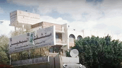 إزالة انسداد المري الخلقي بمولودة في مستشفى السبعين بأمانة العاصمة