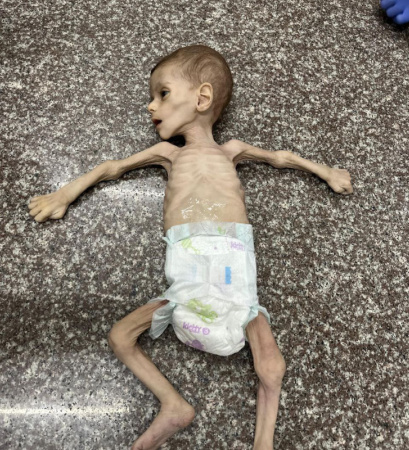 UN Agencies Warn: Gaza on brink of famine UN Agencies Warn: Gaza on brink of famine