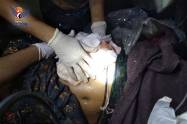 17 citoyens tués et blessés dans des tirs d'artillerie contre des mercenaires de l'agression à Taiz