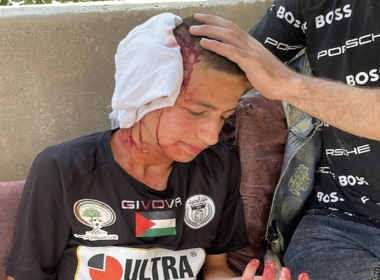 Two injured by 