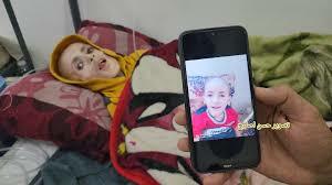 WHO: 32 civilians die of malnutrition in Gaza