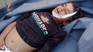 استشهاد طفل بقذيفة أطلقها مرتزقة العدوان على قرية الكامة في مديرية مقبنة بتعز