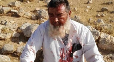 Verletzung eines palästinensischen bei einem Siedlerangriff südlich von Hebron