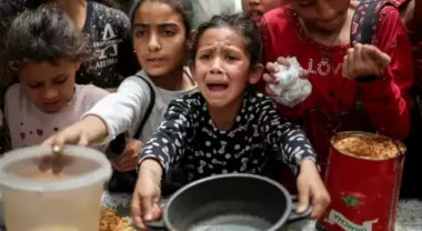 مجمع ناصر بغزة: القطاع أمام موجة كبيرة من الوفيات بسبب سوء التغذية