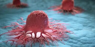 علماء روس يكتشفون مؤشراً يؤكد الإصابة بسرطان البروستاتا