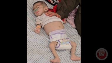 Palästinensisches Mädchen stirbt in Gaza an Hunger – Zahl der Opfer steigt auf 54