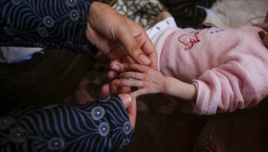 استشهاد طفلة تبلغ عام ونصف بسبب سوء التغذية في دير البلح بقطاع غزة