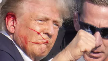 Trump under fire.. Bled a lot