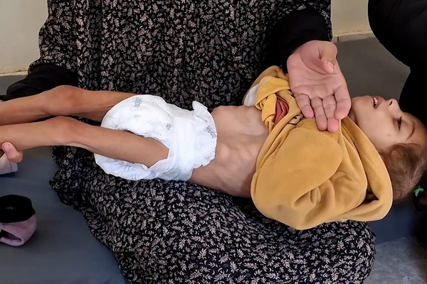 American Doctor: Gaza Famine Forcing Premature Births and Extremely Undersized Newborns American Doctor: Gaza Famine Forcing Premature Births and Extremely Undersized Newborns
