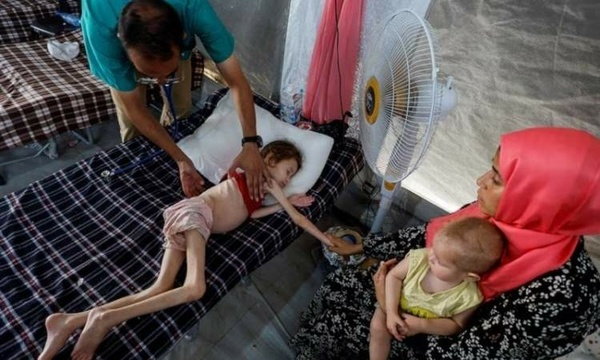 Death toll rises due to famine and malnutrition Death toll rises due to famine and malnutrition
