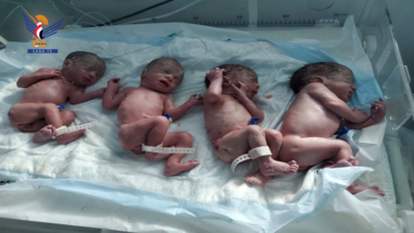 ولادة اربعة توائم في مستشفى السبعين بأمانة العاصمة