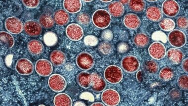 WHO: Africa records 14,700 monkeypox new cases in 2024