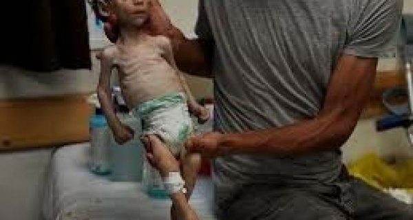 الأمهات والأطفال: التجويع يفتك بحاضر غزة ومستقبلها 