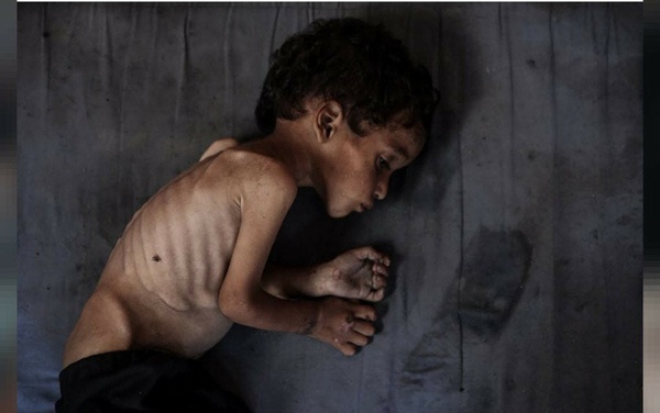 UN Secretary-General: Gaza population facing humanitarian catastrophe of horrific dimensions UN Secretary-General: Gaza population facing humanitarian catastrophe of horrific dimensions