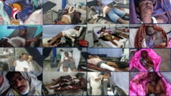 2909 Märtyrer und Verwundete bei saudischer Bombardierung der Grenzgebiete